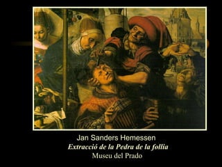 Jan Sanders Hemessen   Extracció de la Pedra de la follia Museu del Prado 