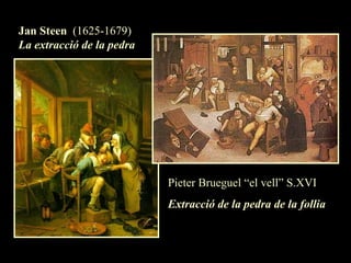 Jan Steen  (1625-1679) La extracció de la pedra   Pieter Brueguel “el vell” S.XVI Extracció de la pedra de la follia 