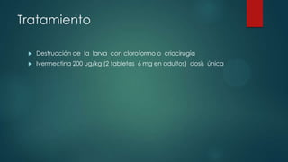 Tratamiento
 Destrucción de la larva con cloroformo o criocirugía
 Ivermectina 200 ug/kg (2 tabletas 6 mg en adultos) dosis única
 