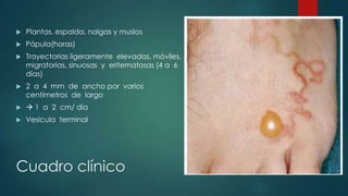 Cuadro clínico
 Plantas, espalda, nalgas y muslos
 Pápula(horas)
 Trayectorias ligeramente elevadas, móviles,
migratorias, sinuosas y eritematosas (4 a 6
días)
 2 a 4 mm de ancho por varios
centímetros de largo
  1 a 2 cm/ día
 Vesícula terminal
 