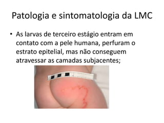 Patologia e sintomatologia da LMC
• As larvas de terceiro estágio entram em
contato com a pele humana, perfuram o
estrato epitelial, mas não conseguem
atravessar as camadas subjacentes;
 