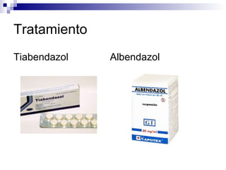 Tratamiento
Tiabendazol   Albendazol
 