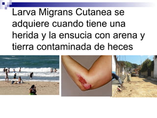 Larva Migrans Cutanea se
adquiere cuando tiene una
herida y la ensucia con arena y
tierra contaminada de heces
 