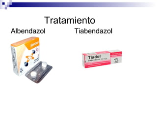 Tratamiento
Albendazol     Tiabendazol
 