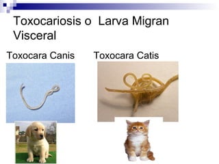 Toxocariosis o Larva Migran
 Visceral
Toxocara Canis   Toxocara Catis
 