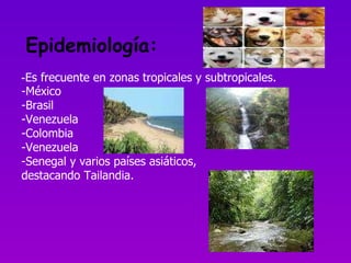 Epidemiología: - Es frecuente en zonas tropicales y subtropicales.   -México  -Brasil -Venezuela -Colombia -Venezuela -Senegal y varios países asiáticos, destacando Tailandia.  