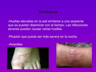 Síntomas -Huellas elevadas en la piel similares a una serpiente que se pueden diseminar con el tiempo. Las infecciones severas pueden causar varias huellas.  -Picazón que puede ser más severa en la noche. -Ampollas 