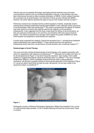 infection was not successfully eliminated, speculating that the treatment may have been
unsuccessful for reasons such as insufficient application of larvae, or that therapy may have
been discontinued too early to allow complete eradication of MRSA. Further research reported
the successful use of larval therapy in the treatment of three wounds infected with MRSA,
however, the author failed to describe the types of wound, their location and their duration.[8]

Preliminary research has indicated that the purified secretions of sterile, aseptically raised L.
sericata larvae exhibited antibacterial activity against MRSA in vitro; although activity was found
to be bacteriostatic rather than bactericidal.[28] The authors remarked that the degree of inhibition
may have varied as a result of the methods used for the collection of the secretions.
Subsequently, it was suggested that the study undervalued the effects of larval secretions, as
they are produced continuously in vivo and thus concentrations within the wound would be
greater. The authors proposed that a stronger action against the growth of MRSA and other
multi-resistant microorganisms could therefore be expected.

A recent study supported this research, finding that secretions from L. sericata larvae displayed
potent antibacterial action against MRSA.[31] It was reported that the most significant
antibacterial activity was from a small fraction of larval secretion with a molecular weight of [28]

Disadvantages of larval Therapy

The most commonly mentioned disadvantage of larval therapy is the negative perception with
which it is regarded by both patients and practitioners.[5,18,32] Although the so-called 'yuk factor' of
its clinical appearance (Figure 1) has been frequently reported in case studies, there is little
evidence to suggest that patients refuse larval therapy when it is offered.[33] The use of 'Biobags'
(Polymedics, Belgium), which completely enclose the larvae within a polyvinylalcohol
membrane, has become a popular method of improving the application of this treatment (Figure
2). Larvae are able to feed freely through the open cell polymer, but are less visible to the
squeamish patient or practitioner.[34]




Figure 1.

Photograph courtesy of Medical Photography Department, Belfast City Hospitals Trust. Larvae
of Lucilia sericata (approximately 15 mm in length) following removal from wound (post 3 days
in contact)
 