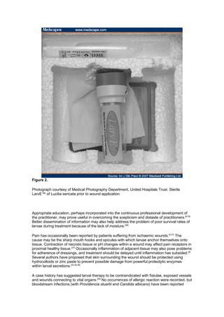 Figure 2.

Photograph courtesy of Medical Photography Department, United Hospitals Trust. Sterile
LarvE™ of Lucilia sericata prior to wound application




Appropriate education, perhaps incorporated into the continuous professional development of
the practitioner, may prove useful in overcoming the scepticism and distaste of practitioners.[8,35]
Better dissemination of information may also help address the problem of poor survival rates of
larvae during treatment because of the lack of moisture.[36]

Pain has occasionally been reported by patients suffering from ischaemic wounds.[9,37] The
cause may be the sharp mouth hooks and spicules with which larvae anchor themselves onto
tissue. Contraction of necrotic tissue or pH changes within a wound may affect pain receptors in
proximal healthy tissue.[37] Occasionally inflammation of adjacent tissue may also pose problems
for adherence of dressings, and treatment should be delayed until inflammation has subsided.[8]
Several authors have proposed that skin surrounding the wound should be protected using
hydrocolloids or zinc paste to prevent possible damage from powerful proteolytic enzymes
within larval secretions.[33,38,39]

A case history has suggested larval therapy to be contraindicated with fistulae, exposed vessels
and wounds connecting to vital organs.[40] No occurrences of allergic reaction were recorded, but
bloodstream infections (with Providencia stuartii and Candida albicans) have been reported
 