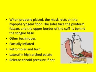• When properly placed, the mask rests on the
hypopharyngeal floor. The sides face the pyriform
fossae, and the upper border of the cuff is behind
the tongue base
• Other techniques
• Partially inflated
• Retromolar and turn
• Lateral in high arched palate
• Release cricoid pressure if not
 