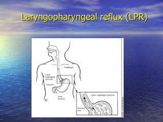 Laryngeal Disorders | PPT
