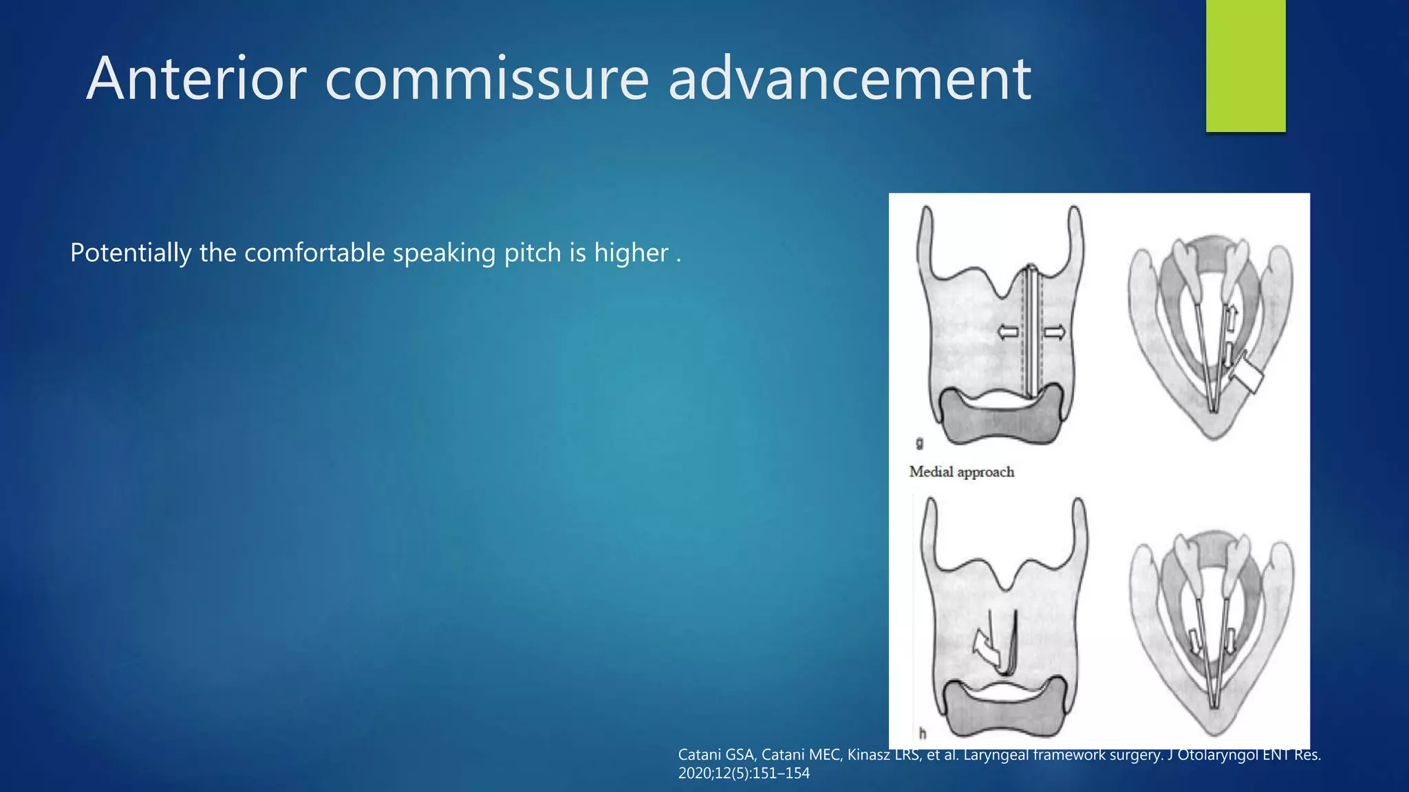 Laryngeal framework surgery | PPTX