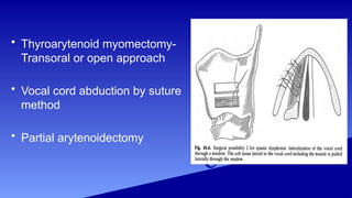 Laryngeal framework surgery and thyroplasty.pptx