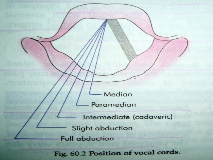 Laryngeal paralysis