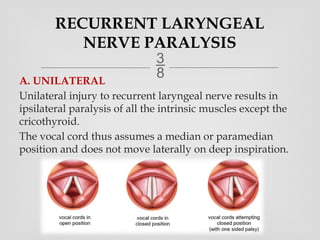 types of laryngeal Paralysis Ear Nose Throat.pptx