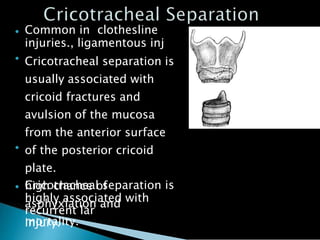 laryngealtrauma-150525133701-lva1-app6892.pptx