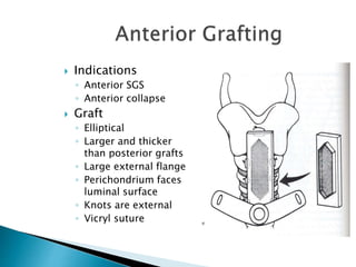  Indications
◦ Anterior SGS
◦ Anterior collapse
 Graft
◦ Elliptical
◦ Larger and thicker
than posterior grafts
◦ Large external flange
◦ Perichondrium faces
luminal surface
◦ Knots are external
◦ Vicryl suture
 