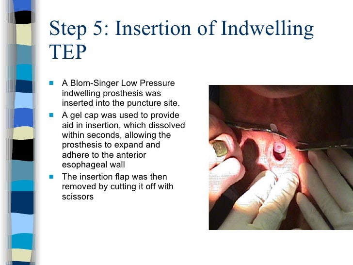 Laryngectomy Rehabiliation1