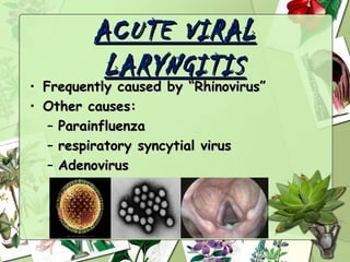 ACUTE VIRAL
          LARYNGITIS
• Frequently caused by “Rhinovirus”
• Other causes:
   – Parainfluenza
   – respiratory syncytial virus
   – Adenovirus
 