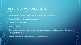 INFECTIOUS MONONUCLEOSIS
• EBV
• Affinity to B lymphocytes , Infect epithelium of oropharynx
• Transmitted through bodily secretions
• Common in adolescent
• IP 4 to 7 weeks
• Sore throat, tonsillar enlargement, periorbital edema and edema of the lower lips-
HOGALAND SIGN
• Palatal petechiae, hepatomegaly, splenomegaly
 