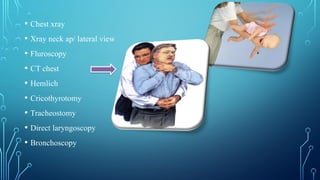• Chest xray
• Xray neck ap/ lateral view
• Fluroscopy
• CT chest
• Hemlich
• Cricothyrotomy
• Tracheostomy
• Direct laryngoscopy
• Bronchoscopy
 
