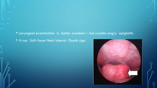 • Laryngeal examination is better avoided – red swollen angry epiglottis
• X-ray Soft tissue Neck lateral- Thumb sign
 