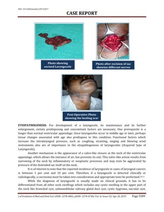 DOI: 10.14260/jemds/2015/817
CASE REPORT
J of Evolution of Med and Dent Sci/ eISSN- 2278-4802, pISSN- 2278-4748/ Vol. 4/ Issue 32/ Apr 20, 2015 Page 5589
ETIOPATHOGENESIS: For development of a laryngocele, its maintenance and its further
enlargement, certain predisposing and concomitant factors are necessary. One prerequisite is a
longer than normal ventricular appendage. Since laryngoceles occur in middle age or later, perhaps
tissue changes associated with age also predispose to this condition. Functional factors which
increase the intralaryngeal pressure, such as coughing, straining, singing and blowing wind
instruments also are of importance in the etiopathogenesis of laryngoceles (Acquired type of
Laryngocele).
Another mechanism is the appearance of a valve-like closure at the neck of the ventricular
appendage, which allows the entrance of air, but prevents its exit. This valve-like action results from
narrowing of the neck by inflammatory or neoplastic processes and may even be aggravated by
pressure of the distended sac itself on the neck.
It is of interest to note that the reported incidence of laryngocele in cases of laryngeal cancers
is between 1 per cent and 10 per cent. Therefore, if a laryngocele is detected clinically or
radiologically, a carcinoma must be taken into consideration and appropriate tests be performed.10,11
While the diagnosis of laryngocele is usually made on clinical grounds, it has to be
differentiated from all other neck swellings which includes any cystic swelling in the upper part of
the neck like branchial cyst, submandibular salivary gland duct cyst, cystic hygroma, saccular cyst,
Photo showing
excised Laryngocele
sac
Photo after excision of sac
showing different nerves
sac
Post-Operative Photo
showing the healing scar
sac
 