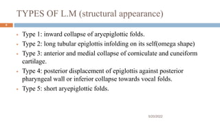 TYPES OF L.M (structural appearance)
 Type 1: inward collapse of aryepiglottic folds.
 Type 2: long tubular epiglottis infolding on its self(omega shape)
 Type 3: anterior and medial collapse of corniculate and cuneiform
cartilage.
 Type 4: posterior displacement of epiglottis against posterior
pharyngeal wall or inferior collapse towards vocal folds.
 Type 5: short aryepiglottic folds.
5/20/2022
6
 