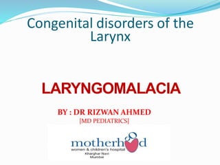 Congenital disorders of the
Larynx
LARYNGOMALACIA
BY : DR RIZWAN AHMED
[MD PEDIATRICS]
 