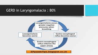 GERD in Laryngomalacia : 80%
 
