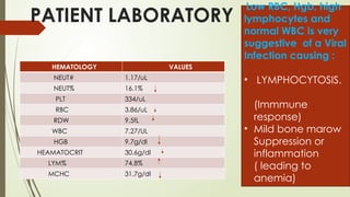 Laryngomalacia Paedaitrics Neonatology Medicine ENT | PPTX