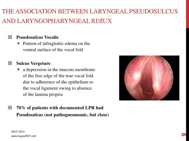 Laryngopharyngeal reflux 2