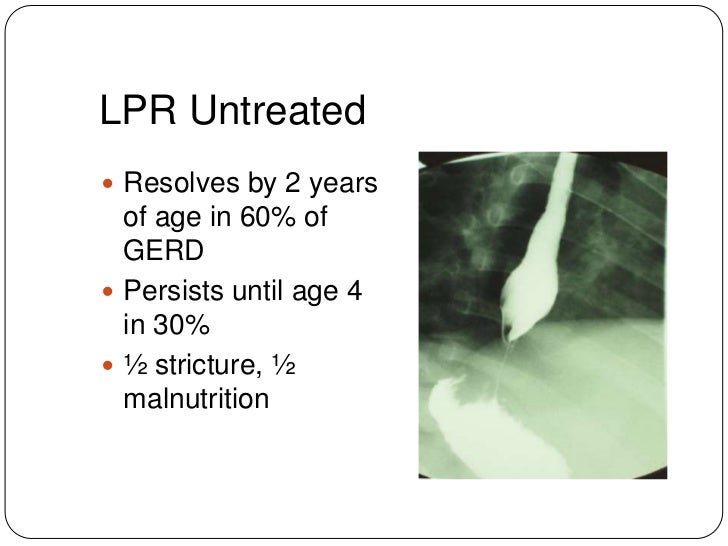 Laryngopharyngeal reflux / ENTARDS