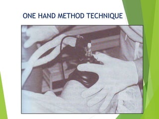 Hand Shield Method #Laryngoscopes face mask-airway & endotracheal tubes | PPTX