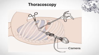 Toracoiscopia laryngoscopy thoracoscopy thoracocentesis pulmonary angiograpy.pptx