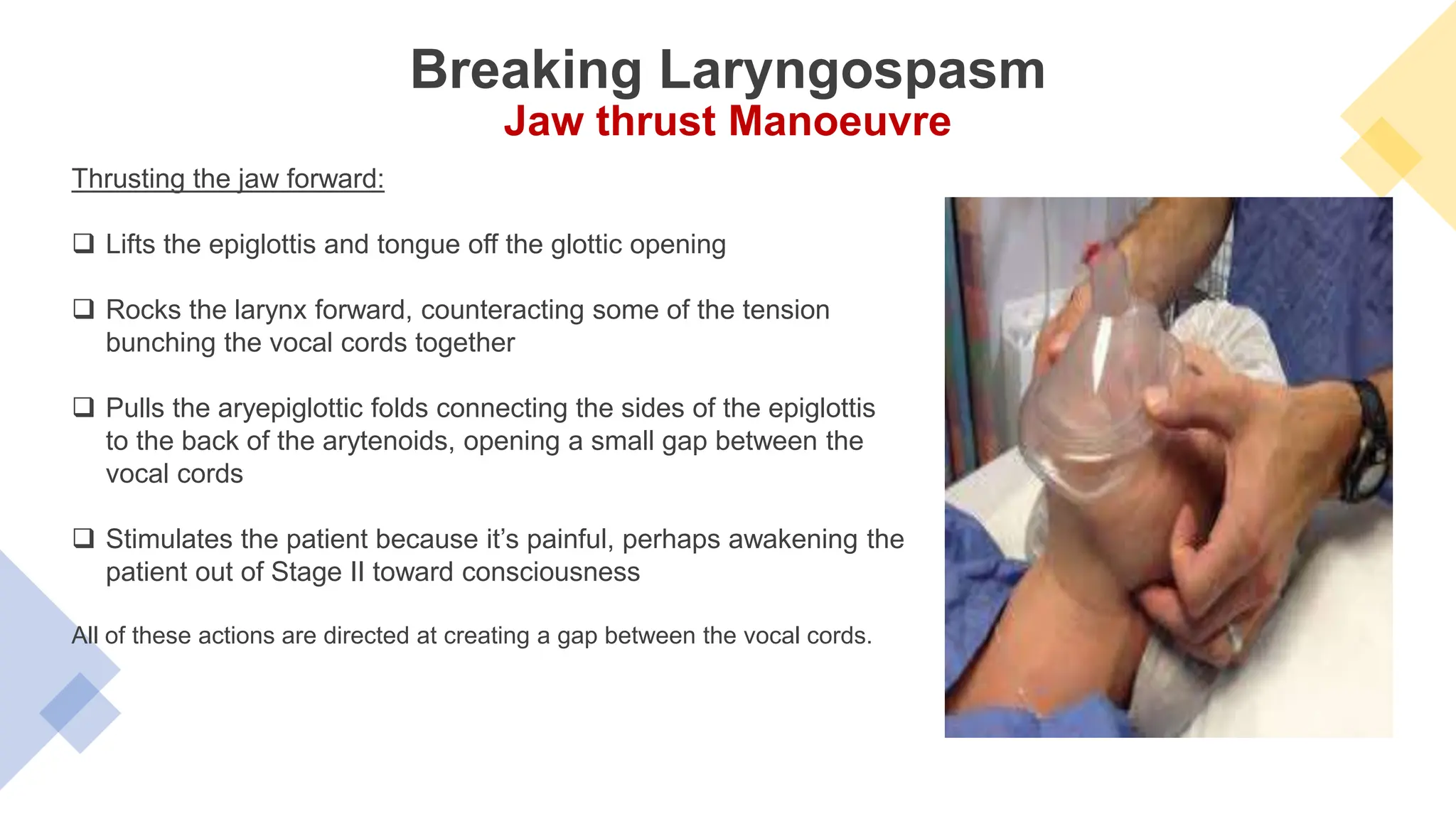 Laryngospasm Presentation.pptx By Ak (Anesthesia ) | PPTX
