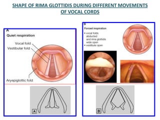 SHAPE OF RIMA GLOTTIDIS DURING DIFFERENT MOVEMENTS
OF VOCAL CORDS
 