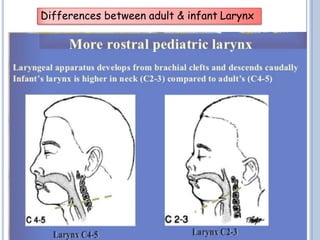 Differences between adult & infant Larynx
 