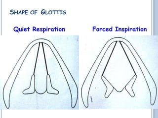 SHAPE OF GLOTTIS
Quiet Respiration Forced Inspiration
 