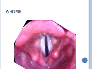 WHISPER
 