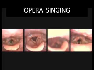 OPERA SINGING
 
