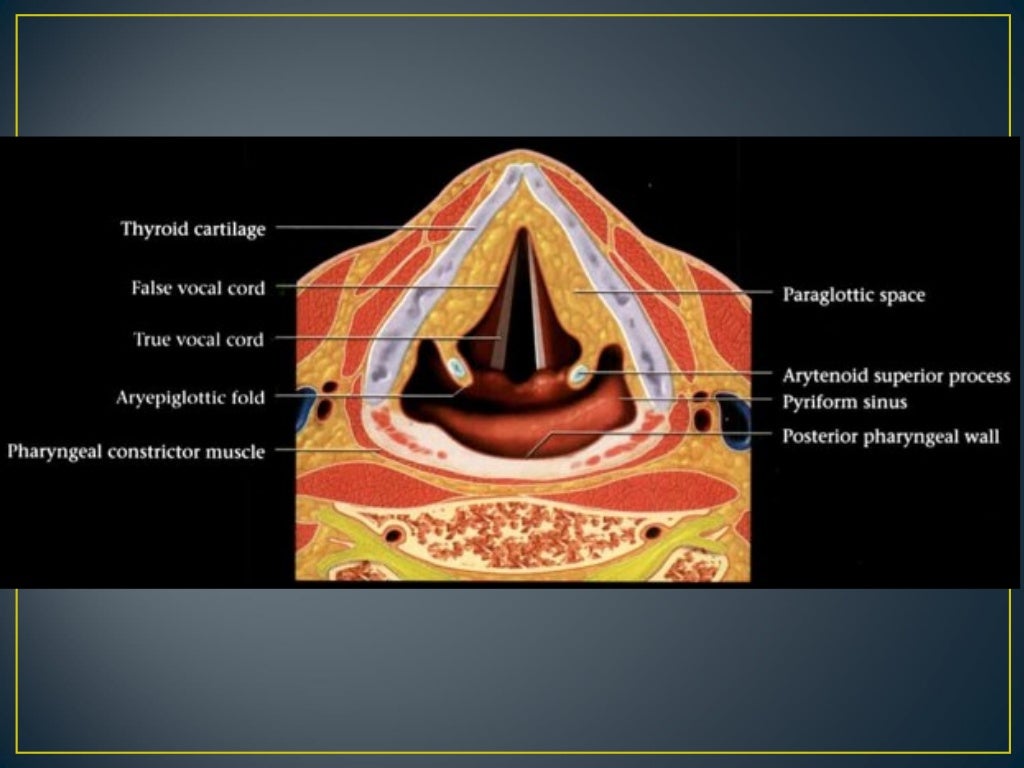 Larynx anatomy ct and mri