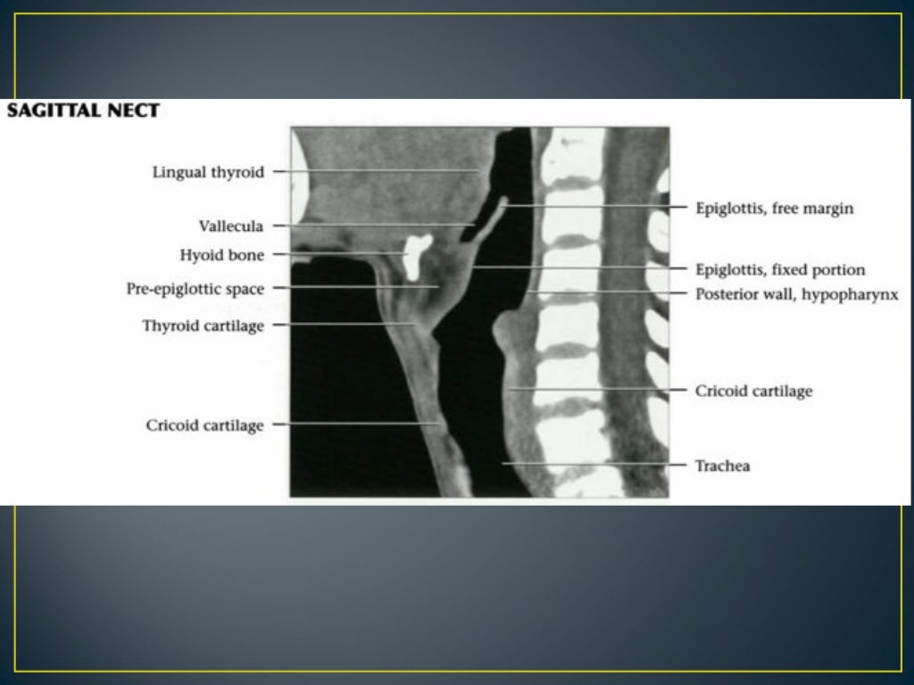 Larynx anatomy ct and mri