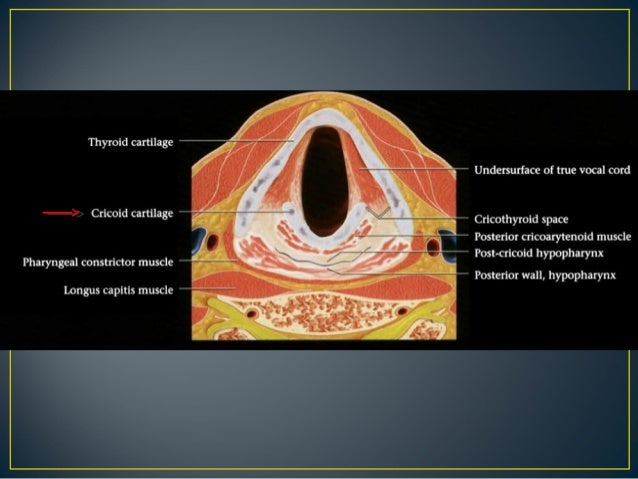 Larynx anatomy CT and MRI