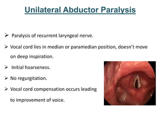 Unilateral Abductor Paralysis
 Paralysis of recurrent laryngeal nerve.
 Vocal cord lies in median or paramedian position, doesn’t move
on deep inspiration.
 Initial hoarseness.
 No regurgitation.
 Vocal cord compensation occurs leading
to improvement of voice.
 