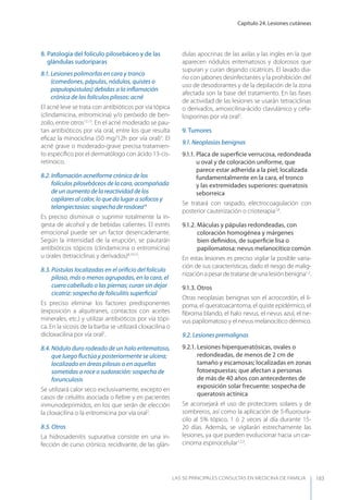 Capítulo 24. Lesiones cutáneas
LAS 50 principALeS conSuLtAS en medicinA de fAmiLiA 183
8. Patología del folículo pilosebáceo y de las
glándulas sudoríparas
8.1. Lesiones polimorfas en cara y tronco
(comedones, pápulas, nódulos, quistes o
papulopústulas) debidas a la inﬂamación
crónica de los folículos pilosos: acné
El acné leve se trata con antibióticos por vía tópica
(clindamicina, eritromicina) y/o peróxido de ben-
zoilo, entre otros12,13
. En el acné moderado se pau-
tan antibióticos por vía oral, entre los que resulta
eﬁcaz la minociclina (50 mg/12h por vía oral)3
. El
acné grave o moderado-grave precisa tratamien-
to especíﬁco por el dermatólogo con ácido 13-cis-
retinoico.
8.2. Inﬂamación acneiforme crónica de los
folículos pilosebáceos de la cara, acompañada
de un aumento de la reactividad de los
capilares al calor, lo que da lugar a sofocos y
telangiectasias: sospecha de rosácea14
Es preciso disminuir o suprimir totalmente la in-
gesta de alcohol y de bebidas calientes. El estrés
emocional puede ser un factor desencadenante.
Según la intensidad de la erupción, se pautarán
antibióticos tópicos (clindamicina o eritromicina)
u orales (tetraciclinas y derivados)8,10,15
.
8.3. Pústulas localizadas en el oriﬁcio del folículo
piloso, más o menos agrupadas, en la cara, el
cuero cabelludo o las piernas; curan sin dejar
cicatriz: sospecha de foliculitis superﬁcial
Es preciso eliminar los factores predisponentes
(exposición a alquitranes, contactos con aceites
minerales, etc.) y utilizar antibióticos por vía tópi-
ca. En la sicosis de la barba se utilizará cloxacilina o
dicloxacilina por vía oral2
.
8.4. Nódulo duro rodeado de un halo eritematoso,
que luego ﬂuctúa y posteriormente se ulcera;
localizado en áreas pilosas o en aquellas
sometidas a roce o sudoración: sospecha de
forunculosis
Se utilizará calor seco exclusivamente, excepto en
casos de celulitis asociada o ﬁebre y en pacientes
inmunodeprimidos, en los que serán de elección
la cloxacilina o la eritromicina por vía oral2
.
8.5. Otros
La hidrosadenitis supurativa consiste en una in-
fección de curso crónico, recidivante, de las glán-
dulas apocrinas de las axilas y las ingles en la que
aparecen nódulos eritematosos y dolorosos que
supuran y curan dejando cicatrices. El lavado dia-
rio con jabones desinfectantes y la prohibición del
uso de desodorantes y de la depilación de la zona
afectada son la base del tratamiento. En las fases
de actividad de las lesiones se usarán tetraciclinas
o derivados, amoxicilina-ácido clavulánico y cefa-
losporinas por vía oral3
.
9. Tumores
9.1. Neoplasias benignas
9.1.1. Placa de superﬁcie verrucosa, redondeada
u oval y de coloración uniforme, que
parece estar adherida a la piel; localizada
fundamentalmente en la cara, el tronco
y las extremidades superiores: queratosis
seborreica
Se tratará con raspado, electrocoagulación con
posterior cauterización o crioterapia7,8
.
9.1.2. Máculas y pápulas redondeadas, con
coloración homogénea y márgenes
bien deﬁnidos, de superﬁcie lisa o
papilomatosa: nevus melanocítico común
En estas lesiones es preciso vigilar la posible varia-
ción de sus características, dado el riesgo de malig-
nización a pesar de tratarse de una lesión benigna1,2
.
9.1.3. Otros
Otras neoplasias benignas son el acrocordón, el li-
poma, el queratoacantoma, el quiste epidérmico, el
ﬁbroma blando, el halo nevus, el nevus azul, el ne-
vus papilomatoso y el nevus melanocítico dérmico.
9.2. Lesiones premalignas
9.2.1. Lesiones hiperqueratósicas, ovales o
redondeadas, de menos de 2 cm de
tamaño y escamosas; localizadas en zonas
fotoexpuestas; que afectan a personas
de más de 40 años con antecedentes de
exposición solar frecuente: sospecha de
queratosis actínica
Se aconsejará el uso de protectores solares y de
sombreros, así como la aplicación de 5-ﬂuoroura-
cilo al 5% tópico, 1 ó 2 veces al día durante 15-
20 días. Además, se vigilarán estrechamente las
lesiones, ya que pueden evolucionar hacia un car-
cinoma espinocelular1,2,3
.
 