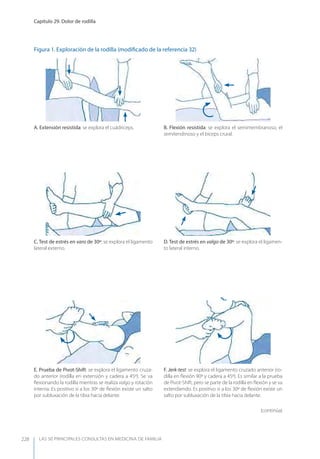 LAS 50 principALeS conSuLtAS en medicinA de fAmiLiA
Capítulo 29. Dolor de rodilla
228
E. Prueba de Pivot-Shift: se explora el ligamento cruza-
do anterior (rodilla en extensión y cadera a 45º). Se va
ﬂexionando la rodilla mientras se realiza valgo y rotación
interna. Es positivo si a los 30º de ﬂexión existe un salto
por subluxación de la tibia hacia delante.
F. Jerk-test: se explora el ligamento cruzado anterior (ro-
dilla en ﬂexión 90º y cadera a 45º). Es similar a la prueba
de Pivot-Shift, pero se parte de la rodilla en ﬂexión y se va
extendiendo. Es positivo si a los 30º de ﬂexión existe un
salto por subluxación de la tibia hacia delante.
Figura 1. Exploración de la rodilla (modiﬁcado de la referencia 32)
C. Test de estrés en varo de 30º: se explora el ligamento
lateral externo.
D. Test de estrés en valgo de 30º: se explora el ligamen-
to lateral interno.
B. Flexión resistida: se explora el semimembranoso, el
semitendinoso y el bíceps crural.
A. Extensión resistida: se explora el cuádriceps.
(continúa)
 