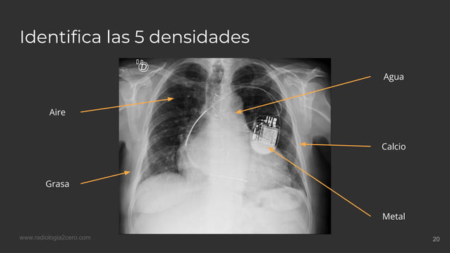Las 5 densidades.pdf