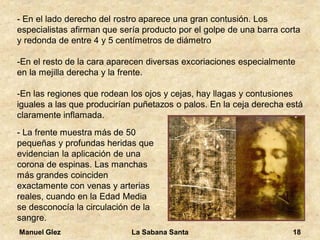 Manuel Glez La Sabana Santa 18 
- En el lado derecho del rostro aparece una gran contusión. Los 
especialistas afirman que sería producto por el golpe de una barra corta 
y redonda de entre 4 y 5 centímetros de diámetro 
-En el resto de la cara aparecen diversas excoriaciones especialmente 
en la mejilla derecha y la frente. 
-En las regiones que rodean los ojos y cejas, hay llagas y contusiones 
iguales a las que producirían puñetazos o palos. En la ceja derecha está 
claramente inflamada. 
- La frente muestra más de 50 
pequeñas y profundas heridas que 
evidencian la aplicación de una 
corona de espinas. Las manchas 
más grandes coinciden 
exactamente con venas y arterias 
reales, cuando en la Edad Media 
se desconocía la circulación de la 
sangre. 
 