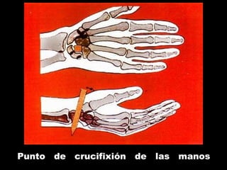 Punto de crucifixión de las manos
 